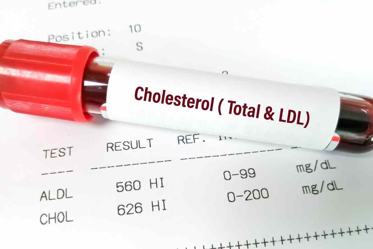 Colesterolo alto, i benefici da richiedere 